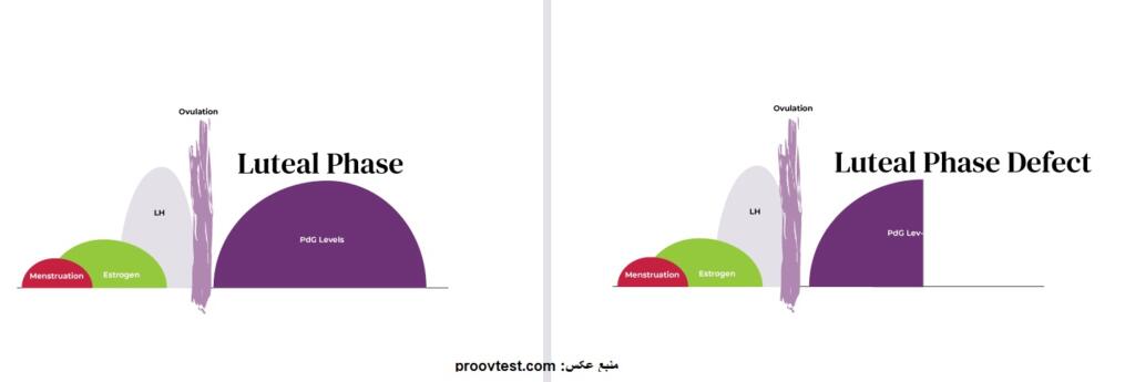 نقص فاز لوتئال