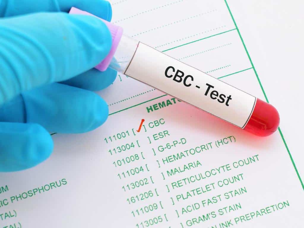 تست کامل خون یا CBC تست MCHC