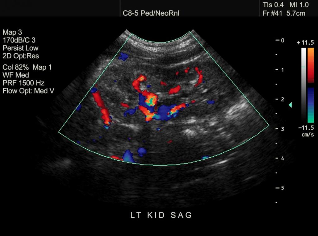 سونوگرافی (ultrasound)؛ انواع کاربردها و آمادگی قبل از آن چیست؟ سونوگرافی