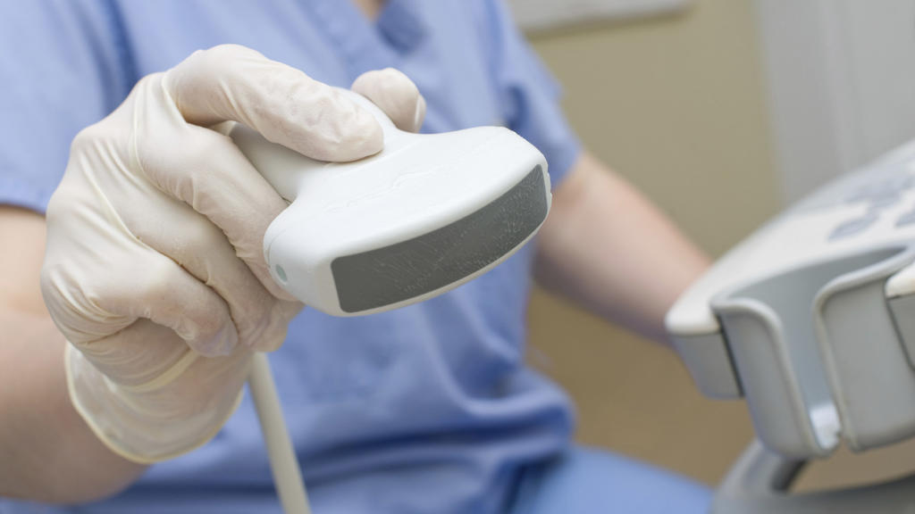 سونوگرافی (ultrasound)؛ انواع کاربردها و آمادگی قبل از آن چیست؟ سونوگرافی داپلر