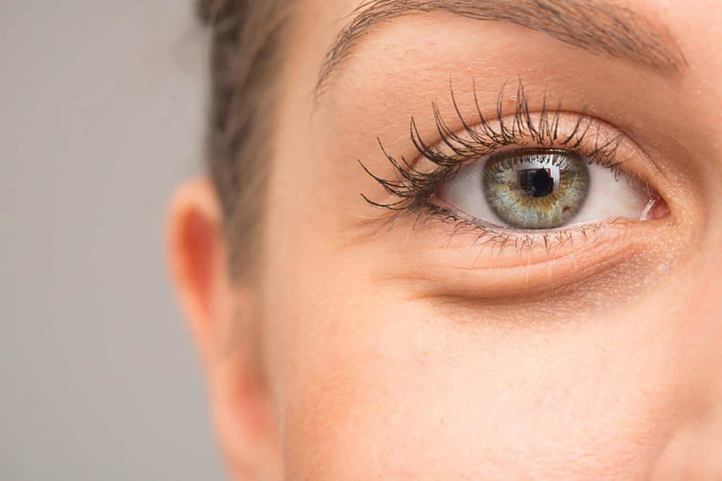 تیرگی زیر چشم علتهای تیرگی زیر چشم
