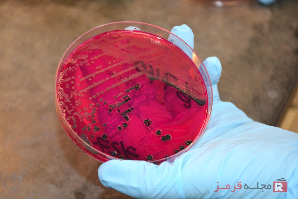 عفونت سالمونلا (Salmonellosis)؛ علائم، تشخیص، درمان و پیشگیری عفونت سالمونلا